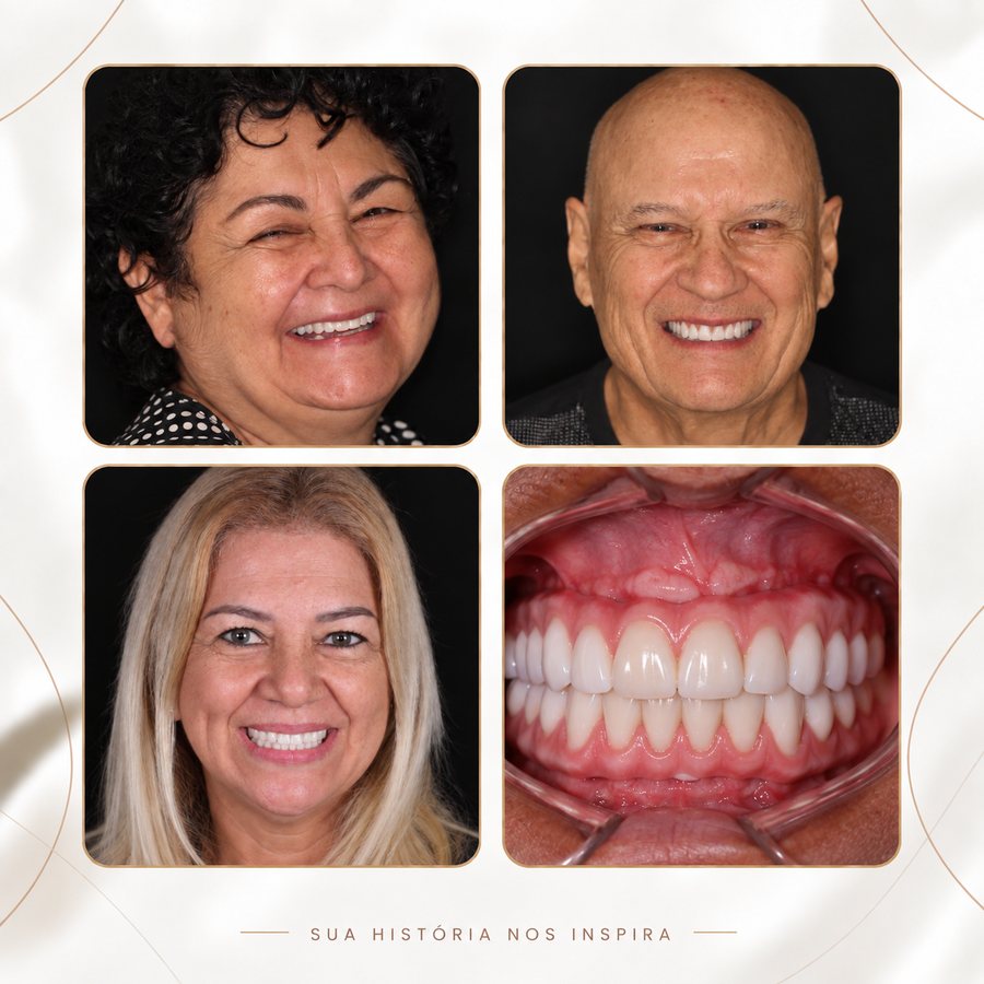 Resultados de pacientes da Oral Unic Campo Grande após protocolo de implante