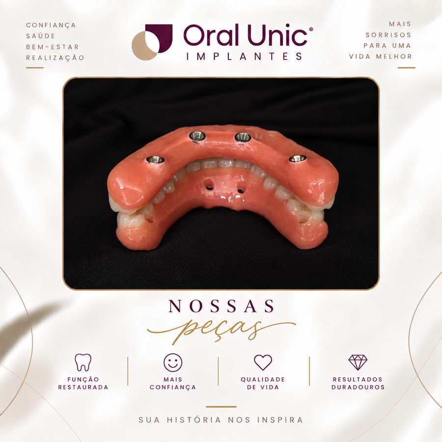 Protocolo de implante fixo produzido pela Oral Unic Campo Grande