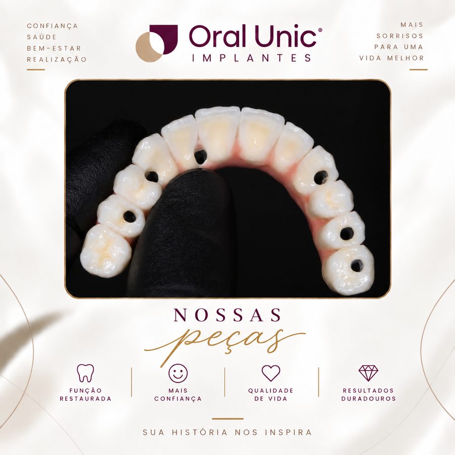 Prótese sobre implante com estrutura parafusada — Oral Unic Campo Grande