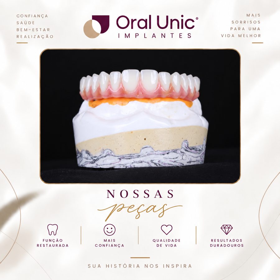 Prótese dentária em fase de produção — Oral Unic Campo Grande