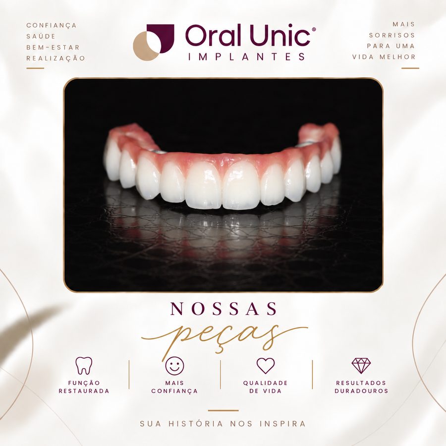 Protocolo dentário fixo finalizado — Oral Unic Campo Grande