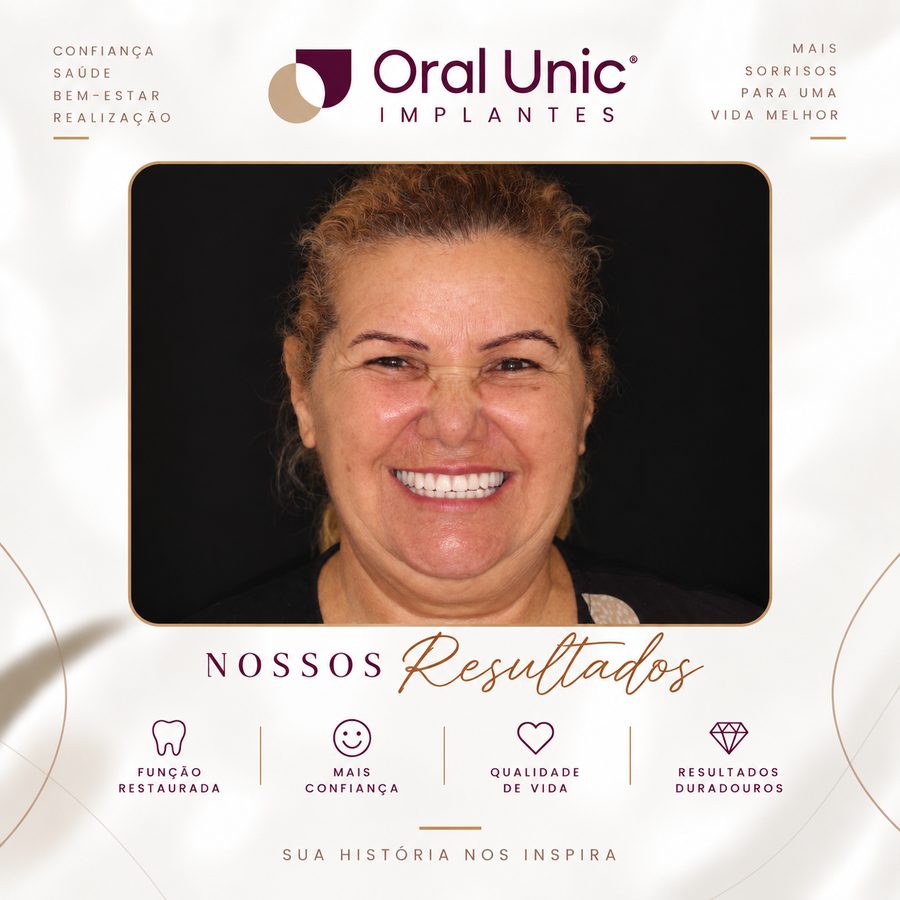 Paciente da Oral Unic Campo Grande sorrindo após tratamento de reabilitação