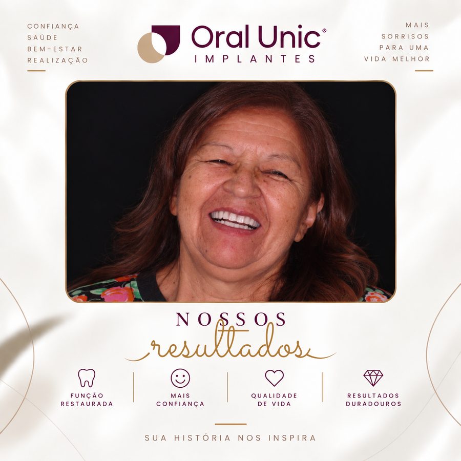 Paciente da Oral Unic Campo Grande sorrindo após protocolo de implante fixo