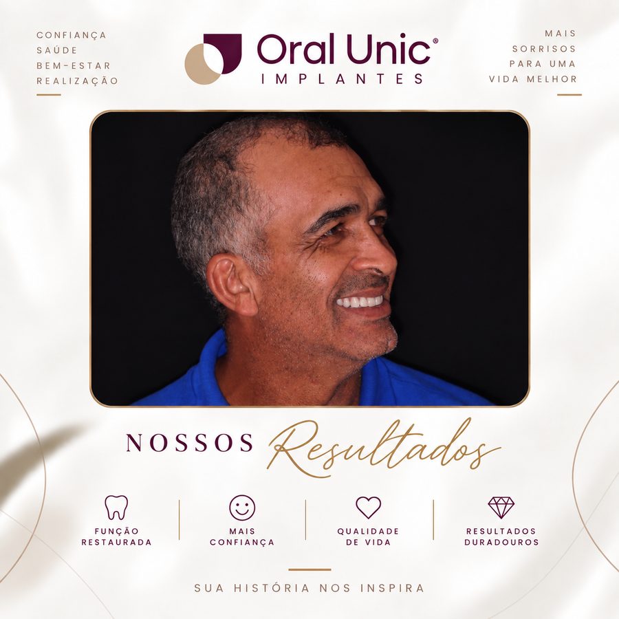 Paciente da Oral Unic Campo Grande sorrindo após reabilitação com prótese sobre implante