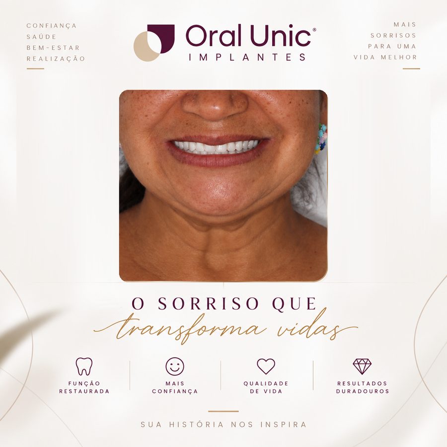 Paciente da Oral Unic sorrindo após reabilitação oral com implantes